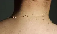 6 مشکل رایج خشکی پوست