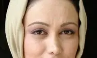 بهنوش بختیاری: از عمل بینی پشیمان‌ ام