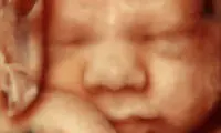 لبخند جالب جنین در رحم +عکس