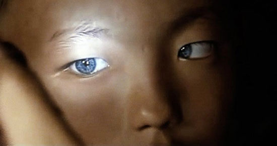 چشمان آبی این بچه پزشکان را حیرت زده کرد
