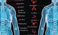 بدشانس ها گرفتار کدام سرطان‌ می‌ شوند؟