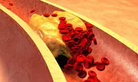 چربی خون نرمال چند است؟