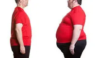 مقایسه 3 روش لیپوماتیک، لیزر لیپولیز و لیپوساکشن