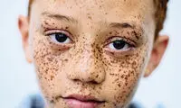 پروژه عکاسی از نژاد مو قرمز ها +عکس