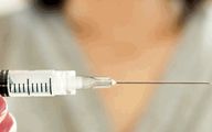 تزریق ژل به واژن (لابیاماژور) | مزایا، عوارض و هزینه
