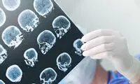رایانه‌ها به جنگ آلزایمر و پارکینسون می‌روند