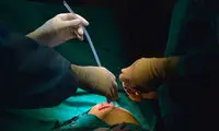 تصاویری شگفت انگیز از عمل قلب باز