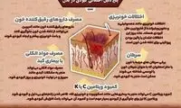 پنج دلیل احتمالیِ کبودی در بدن