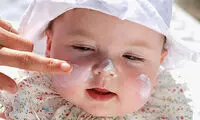 چگونه اگزما کودک‌مان را درمان کنیم؟