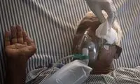 چراییِ ابتلای برخی بیماران کووید به قارچ سیاه