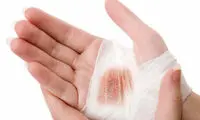 کدام زخم ها به ضد عفونی نیاز دارند؟