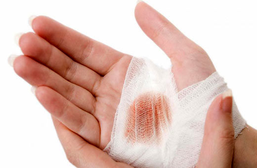کدام زخم ها به ضد عفونی نیاز دارند؟