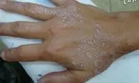 تتوی سفید، فاجعه ی جدید زیبایی! +عکس