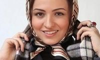 گلاره عباسی: با عمل زیبایی بازیگران مخالفم