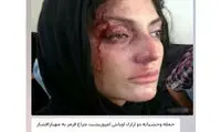 حمله اراذل به «مهناز افشار» صحت دارد؟