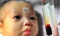 نوزادی که خونش صورتی است +عکس