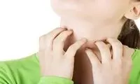 التهاب و خارش پوست را با ۷ روش تضمینی، درمان کنید