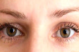 عمل جراحی پلک بالا و پایین (بلفاروپلاستی) چگونه است؟ + عکس