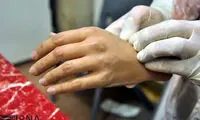 عکس: کارگاه تولید دست و پای مصنوعی