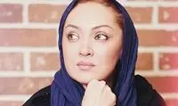 انتقاد نیکی کریمی از جراحی های زیبایی