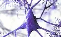  علت جدید ابتلا به آلزایمر کشف شد