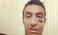 عکس: حادثه تلخ برای کاپیتان سابق استقلال