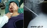 نجات معجزه آسای کارگر چینی +عکس (16+)