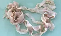 رشد کرم حیوانات در بدن کودک سه ساله