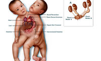 پیچیده‌ ترین عمل جداسازی دوقلوها +عکس