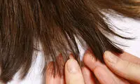 6 ماسک طبیعی برای مبارزه با موخوره
