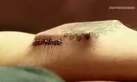هکری که بدن خودش را هک کرد! +عکس