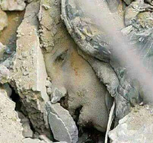 عکس: کودکی که زیر بمباران دفن شد