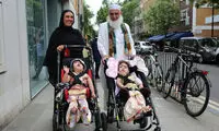 جداسازی دوقلو‌های پاکستانی پس از ۵۰ ساعت جراحی