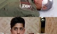 هزینه‌های درمان کولبر ۱۴ساله تامین شد
