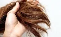روشی موثر برای توقف ریزش مو