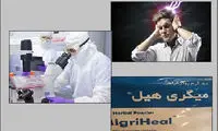 زمان تولید داروی میگرن در ایران