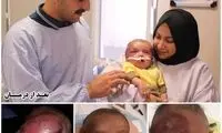 سندروم کُشنده کودک عراقی در مشهد درمان شد