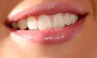 لثه سالم چه شکلی است؟