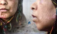 پدیده ای پیچیده به نام «سادومازوخیسم»