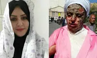 قربانی اسیدپاشی تبریز: تهدیدهایش را جدی نگرفتم