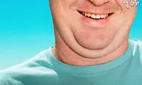 چگونه چربی گردن را از بین ببریم؟
