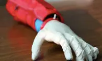 ابداع بازوی مصنوعی خورشیدی برای کودک ۸ساله