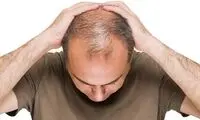 پیشگیری از ریزش مو‌ با ۷ خوراکی موثر