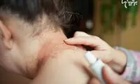 علائم عجیبی که خبر از یک بیماری جدی می‌دهند