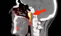 با عضو جدید بدن که از آن خبر ندارید، آشنا شوید