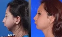 زندگی دختری بدون فک +عکس