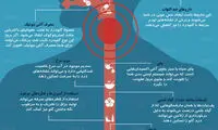 اینفوگرافی: ۱۰ راه ساده برای درمان گلودرد