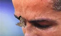 شاپرک مسی بر گونه رونالدو! +عکس