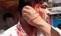 طالبان گوش یک مأمور ترافیک را در ملاعام برید!