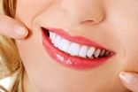 قیمت لمینت دندان در سال 1404 | هزینه لمینت هر واحد دندان
